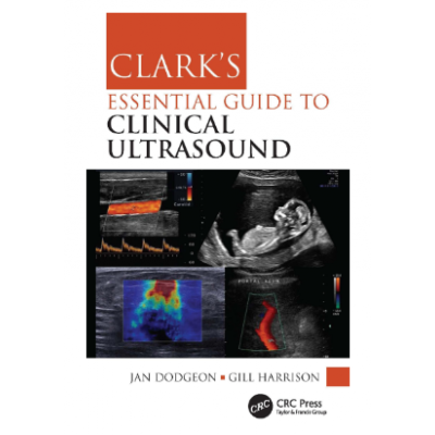 Clark's Essential Guide to Clinical Ultrasound;1st Edition 2023 by Jan Dodgeon & Gill Harrison