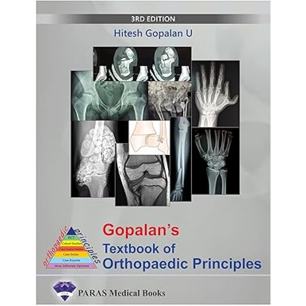 Gopalan's Textbook of Orthopaedic Principles : 3rd Edition 2024 By Hitesh Gopalan U