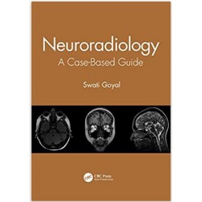 Neuroradiology: A Case-Based Guide 2021 By Swati Goyal