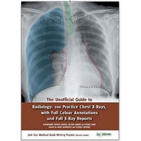 The Unofficial Guide to Radiology:100 Practice Chest X-Rays (Unofficial Guides to Medicine);1st Edition 2017 By Zeshan Qureshi