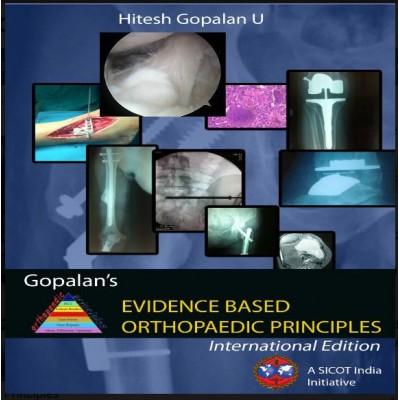 Gopalan's Evidence Based Orthopaedic Principles;2nd(Reprint)Edition 2015 by Hitesh Gopalan