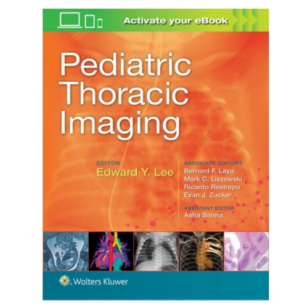 Pediatric Thoracic Imaging;2018 By Edward Y.Lee