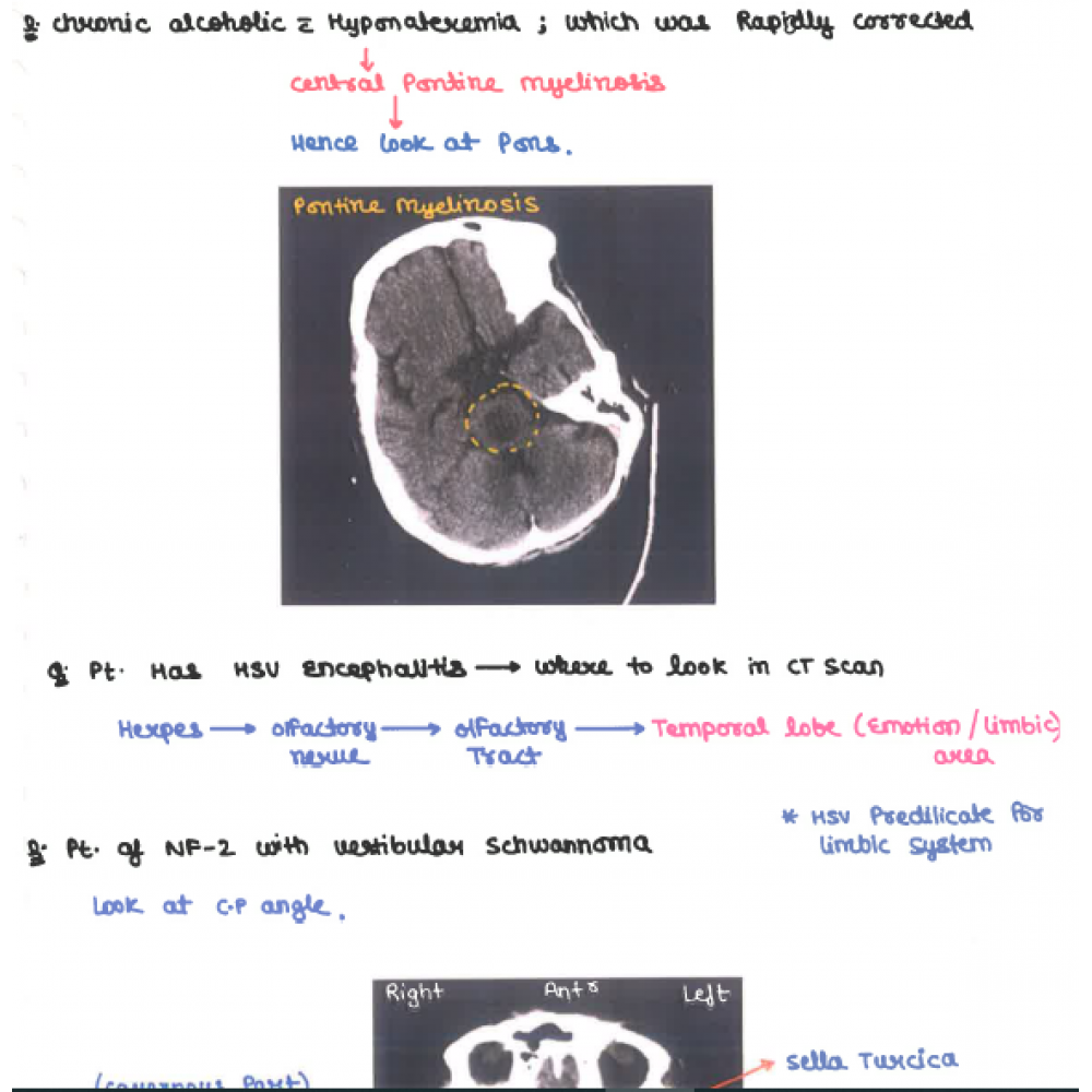 Radiology DAMS PG-Hand Written (Colored ) Notes 2022-23