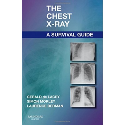 The Chest X-Ray: A Survival Guide;1st Edition 2008 By Gerald De Lacey, Morley Simon & Berman Laurence