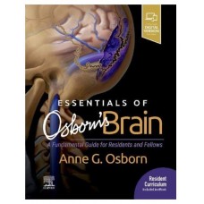 Essentials of Osborn's Brain: A Fundamental Guide for Residents and Fellows;1st Edition 2020 By Anne G. Osborn 