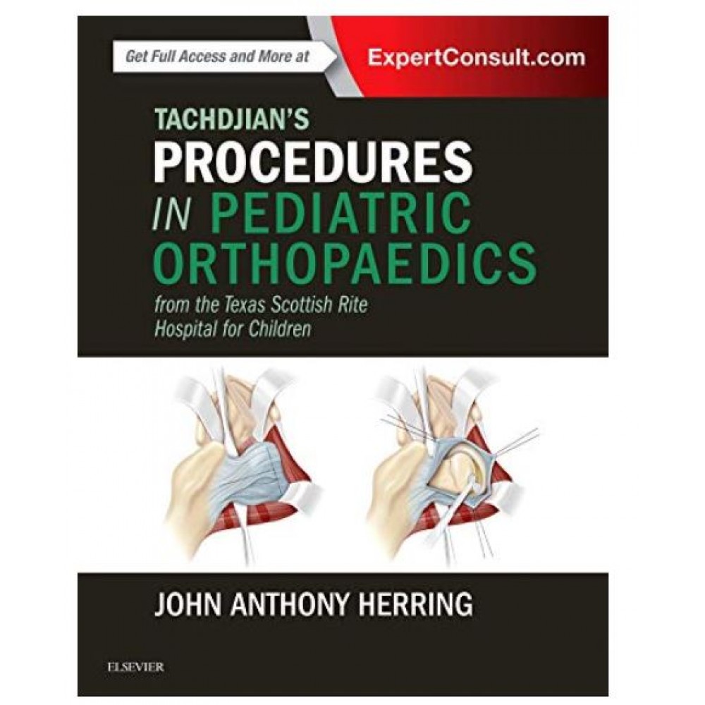 Tachdjian's Procedures in Pediatric Orthopaedics: From the Texas Scottish Rite Hospital for Children;1st Edition 2016 By John A. Herring