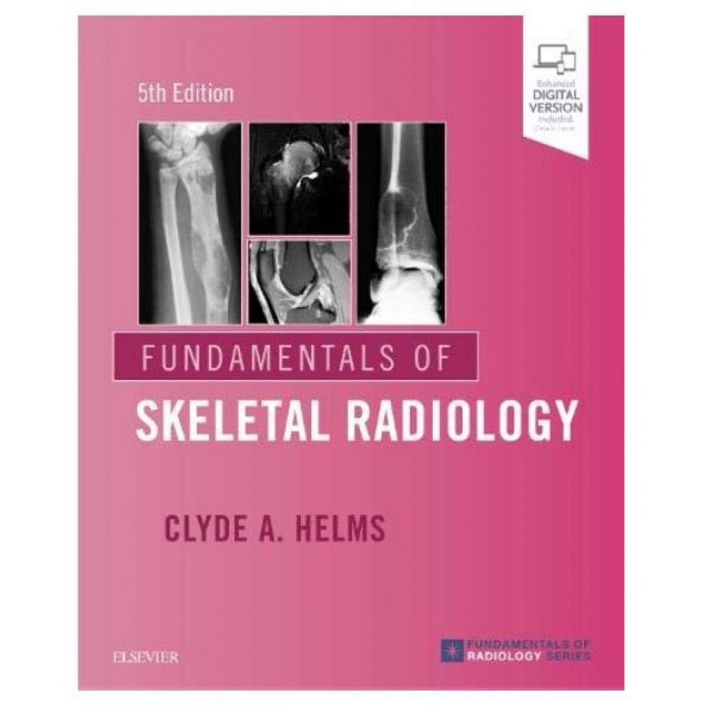 Fundamentals of Skeletal Radiology;5th Edition 2019 By Clyde A.Helms