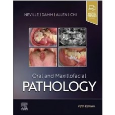 Oral and Maxillofacial Pathology With Access Code: 5th Edition 2023 By Neville & Damm