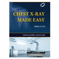 Chest X-Ray Made Easy;5th (South Asia) Edition 2023 By Jonathan Corne