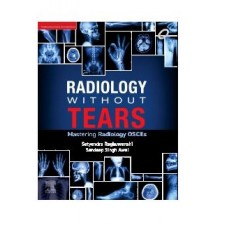 Radiology without Tears Mastering Radiology OSCEs;1st Edition 2024 by Satyendra Raghuwanshi