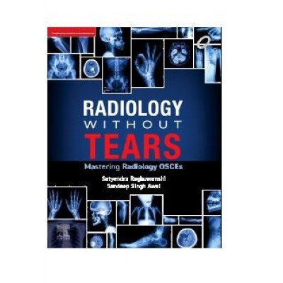 Radiology without Tears Mastering Radiology OSCEs;1st Edition 2024 by Satyendra Raghuwanshi