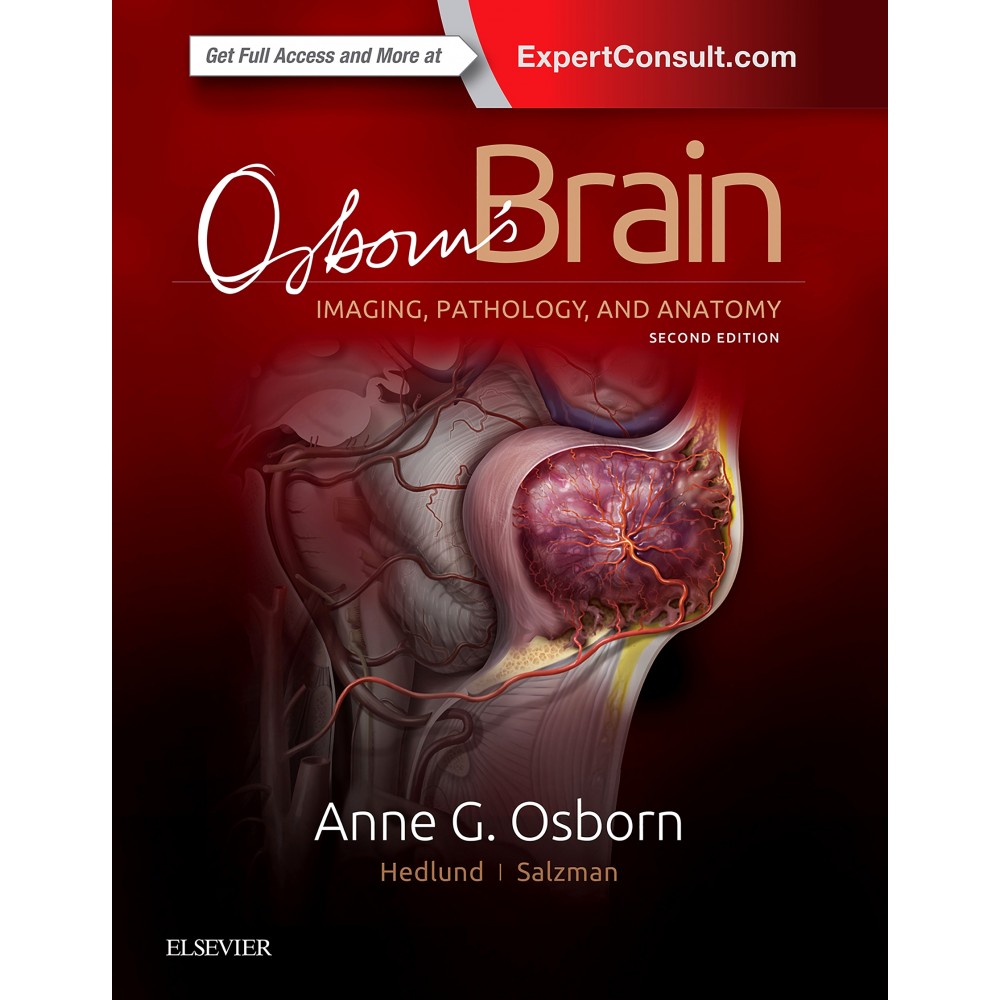 Osborn's Brain;2nd Edition 2017 By Anne G. Osborn,Gary Hedlund & Karen L. Salzman