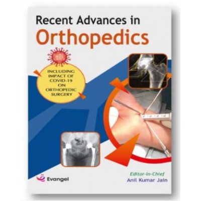 Recent Advances in Orthopedics;1st Edition 2021 by Anil Kumar Jain 