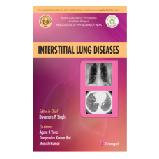 Interstitial Lung Disease;1st Edition 2023 by Devendra P Singh & Deependra Kumar Rai