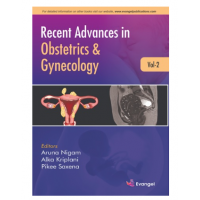 Recent Advances in Obstetrics & Gynecology (Vol.2);1st Edition 2022 by Aruna Nigam, Alka Kriplani & Pikee Saxena