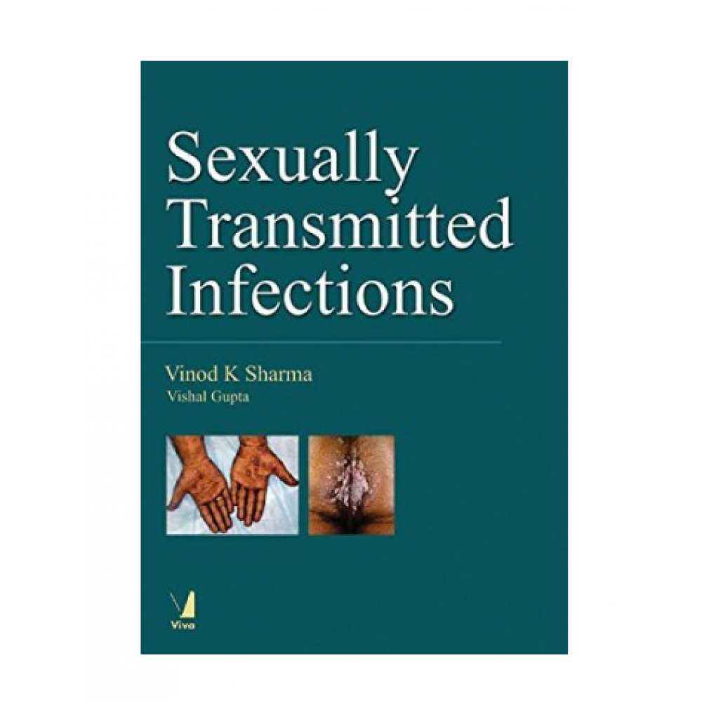 Sexually Transmitted Infections;1st Edition 2018 By Vinod K Sharma & Vishal Gupta