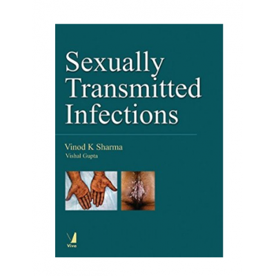 Sexually Transmitted Infections;1st Edition 2018 By Vinod K Sharma & Vishal Gupta