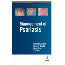 Management of Psoriasis;1st Edition 2025 by Neena Khanna, Sachin Gupta & Bela Bhat