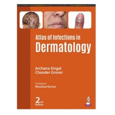 Atlas of Infections in Dermatology;2nd Edition 2025 by Archana Singal & Chander Grover