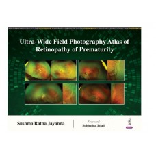 Ultra-Wide Field Photography Atlas of Retinopathy of Prematurity;1st Edition 2024 by Sushma Ratna Jayanna