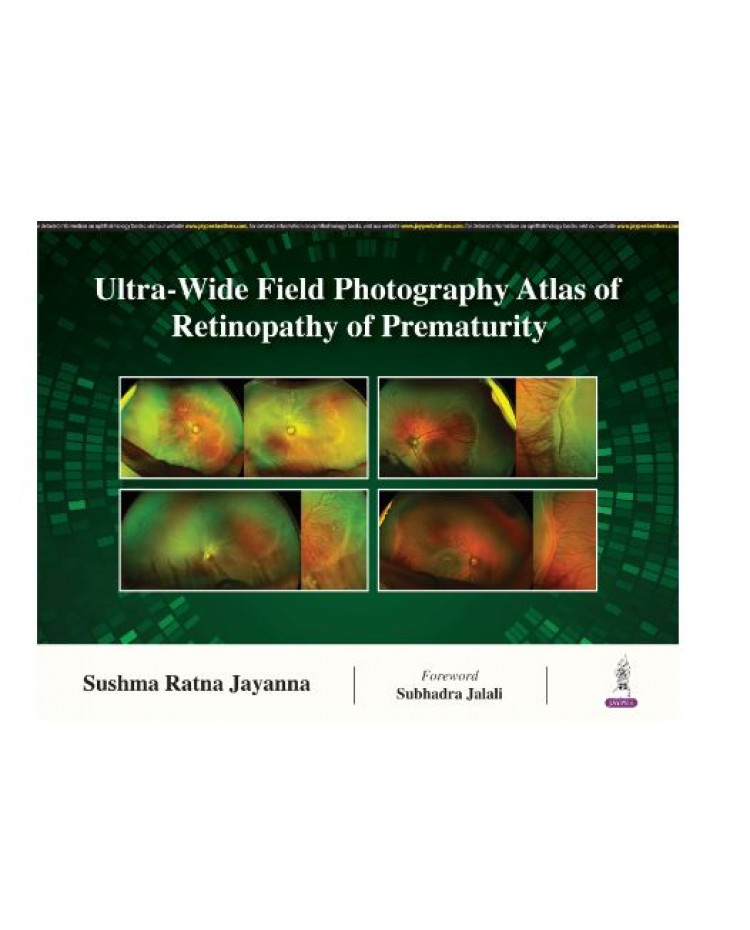 Ultra-Wide Field Photography Atlas of Retinopathy of Prematurity;1st Edition 2024 by Sushma Ratna Jayanna