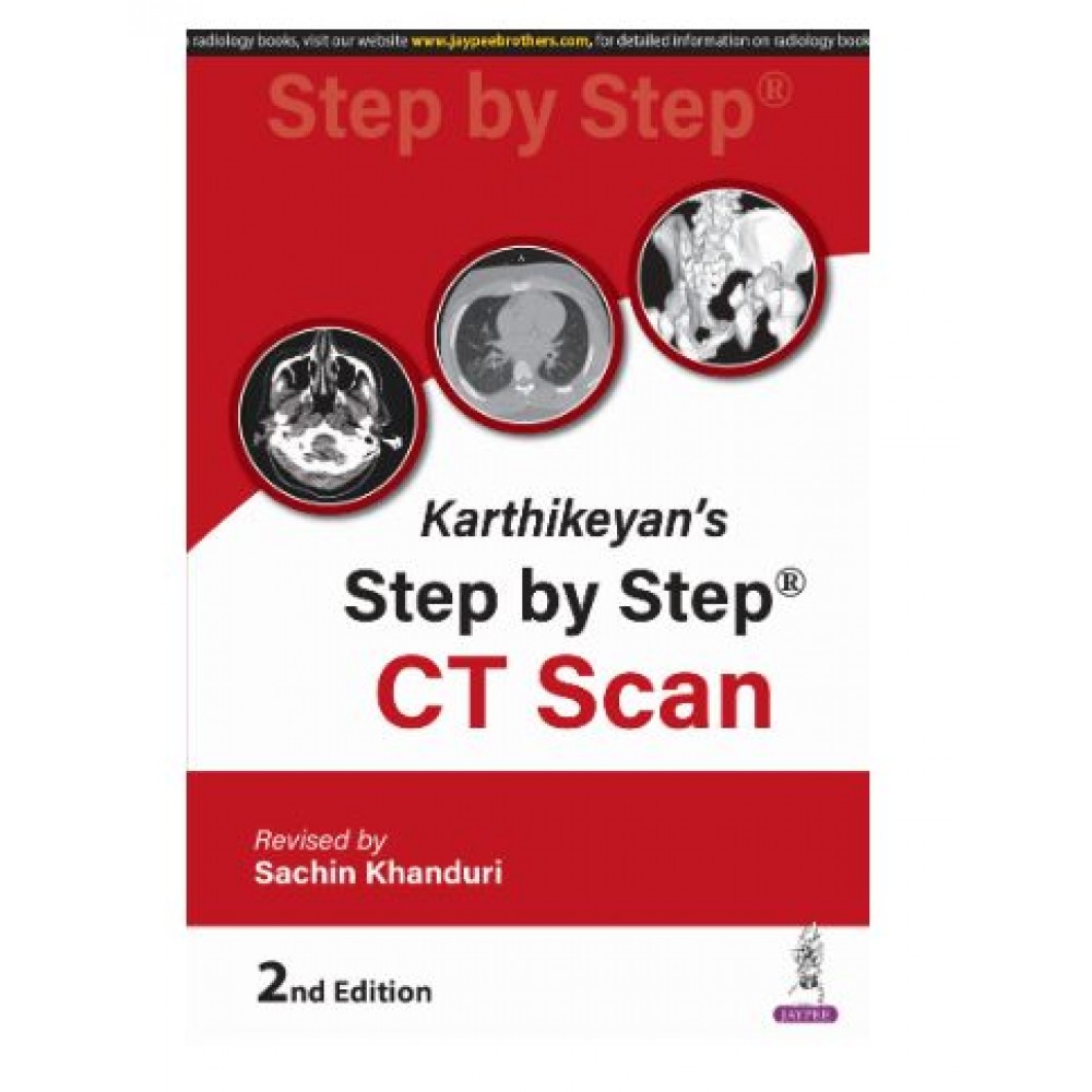 Karthikeyan's Step by Step CT Scan;2nd Edition 2025 by Sachin Khanduri 