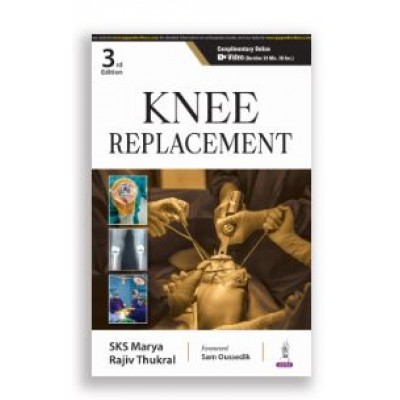 Knee Replacement;3rd Edition 2025 by Rajiv Thukral & SKS Marya 