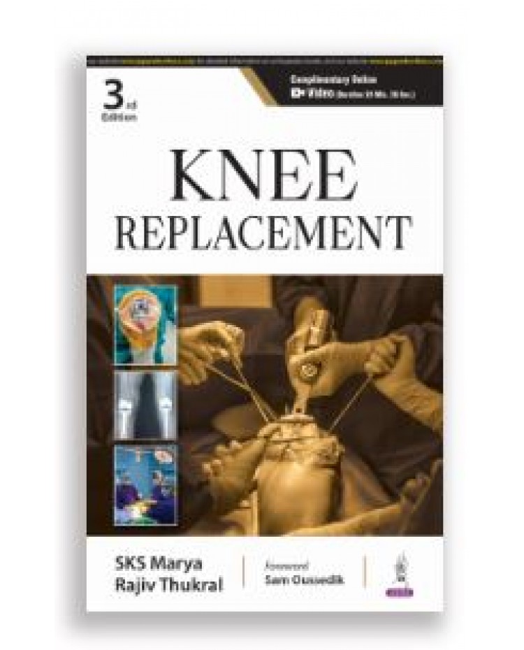 Knee Replacement;3rd Edition 2025 by Rajiv Thukral & SKS Marya 