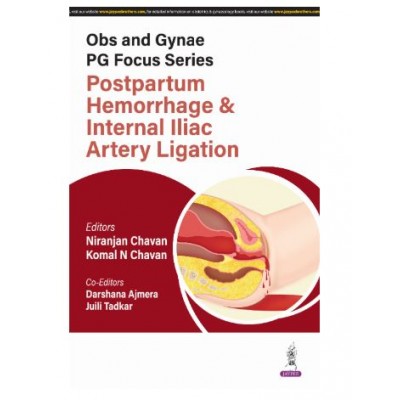 Obs and Gynae PG Focus Series: Postpartum Hemorrhage and Internal Iliac Artery Ligation;1st Edition 2025 by Niranjan Chavan & Komal Chavan