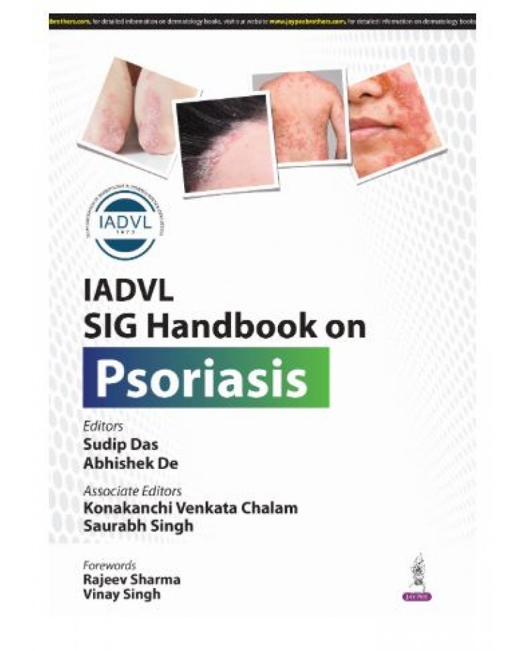 IADVL SIG Handbook on Psoriasis;1st Edition 2025 by Sudip Das & Abhishek De