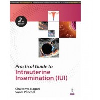 Practical Guide to Intrauterine Insemination;2nd Edition 2025 by Chaitanya Nagori