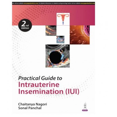 Practical Guide to Intrauterine Insemination;2nd Edition 2025 by Chaitanya Nagori