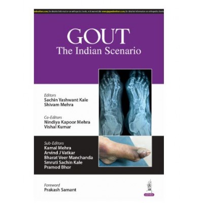 Gout: The Indian Scenario;1st Edition 2025 by Sachin Yashwant Kale, Shvam Mehra & Nindiya Kapoor Mehra