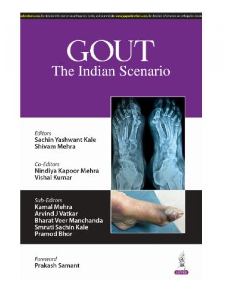 Gout: The Indian Scenario;1st Edition 2025 by Sachin Yashwant Kale, Shvam Mehra & Nindiya Kapoor Mehra