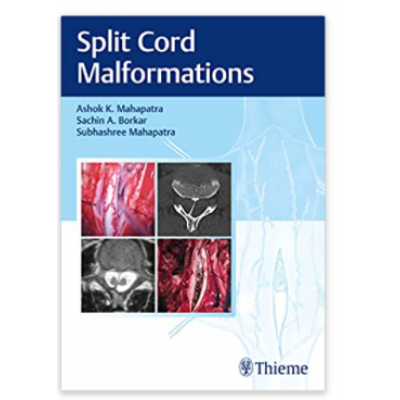 Split Cord Malformations;1st Edition 2021 By Ashok K.Mahapatra, Sachin A. Borkar & Subhashree Mahapatra