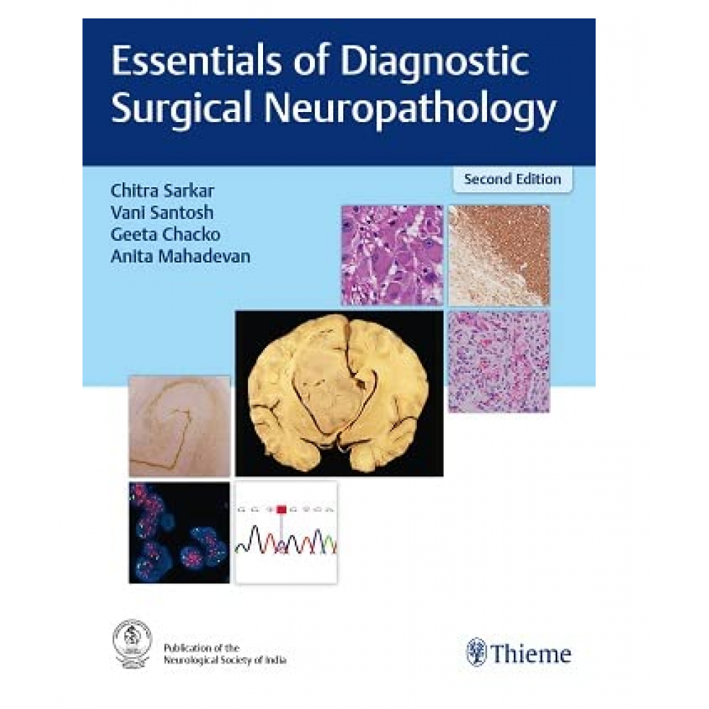 Essentials of Diagnostic Surgical Neuropathology;2nd Edition 2023 by Chitra Sarkar, Vani Santosh & Anita Mahadevan 