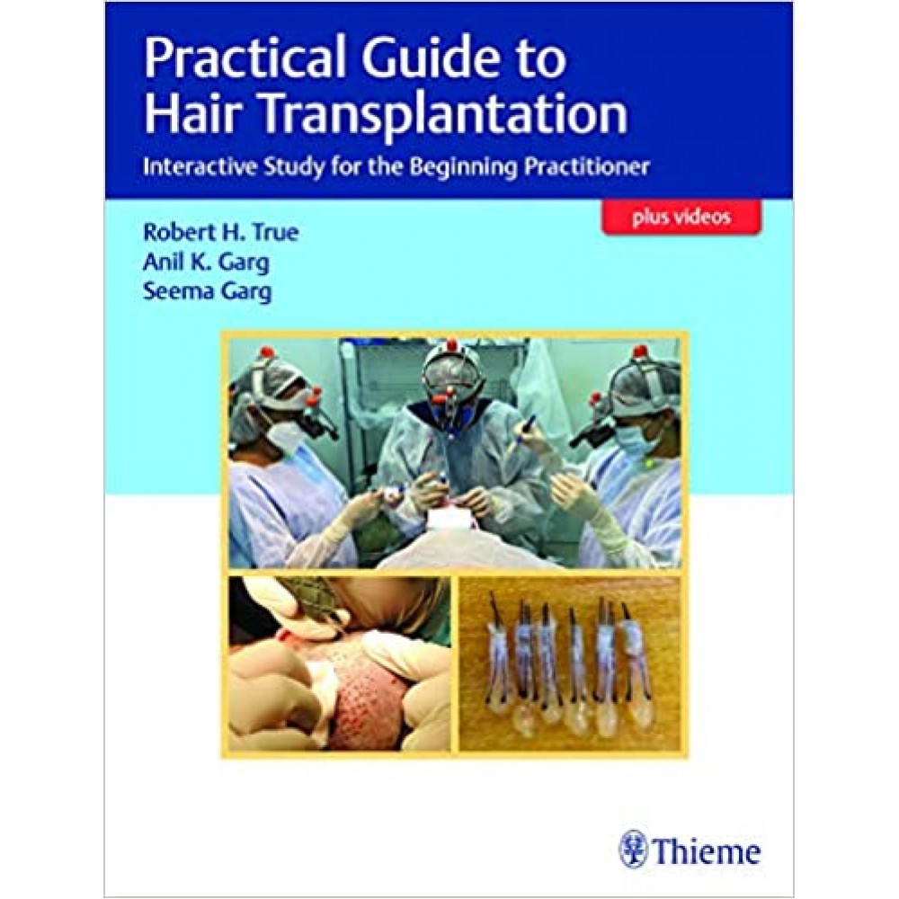 Practical Guide to Hair Transplantation;1st edition 2021 by Robert True