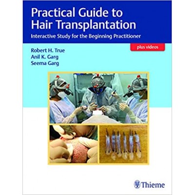 Practical Guide to Hair Transplantation;1st edition 2021 by Robert True