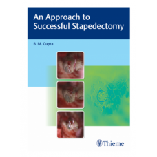 An Approach to Successful Stapedectomy;1st Edition 2022 by B M Gupta