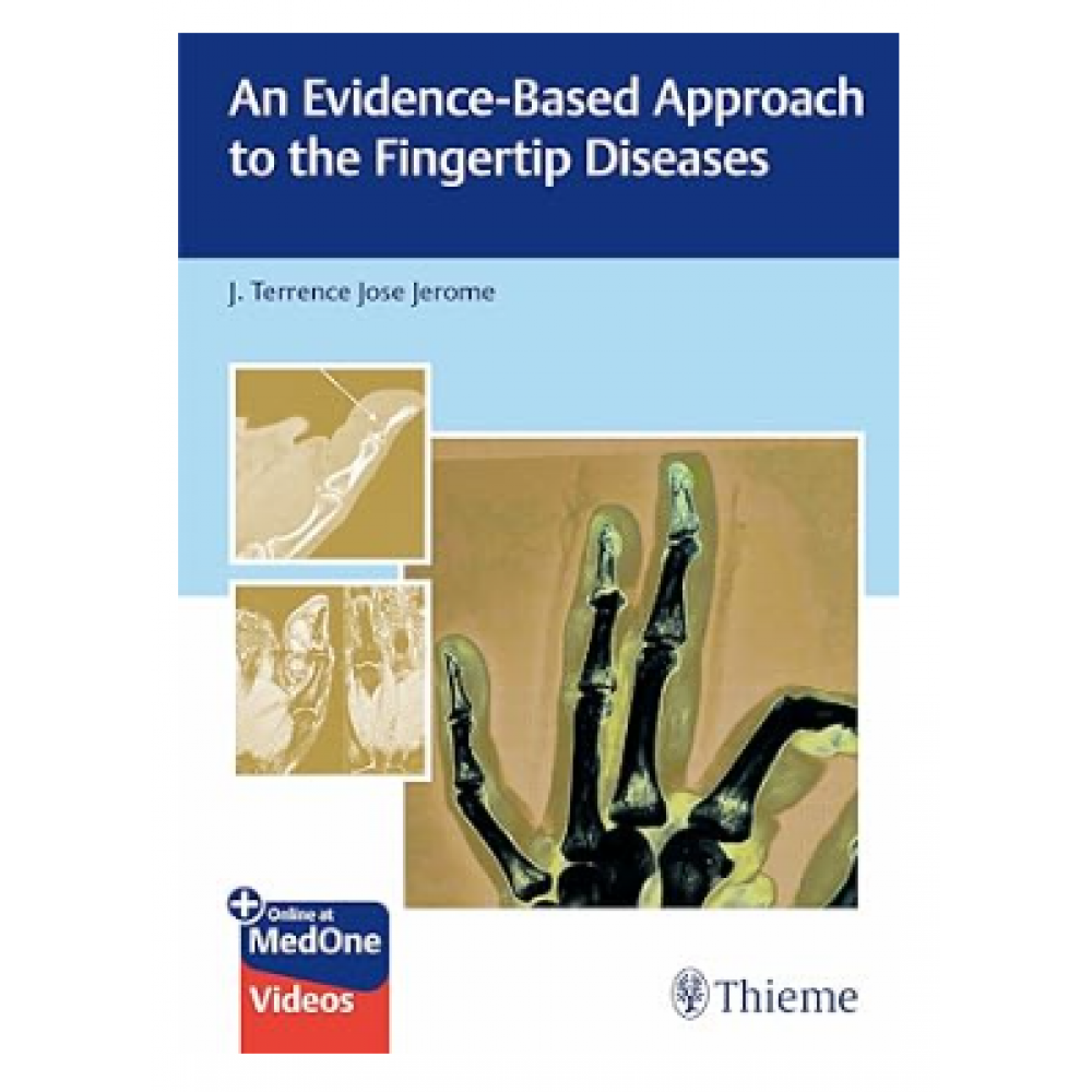 An Evidence-Based Approach to the Fingertip Diseases;1st Edition 2023 by Terrence Jose Jerome