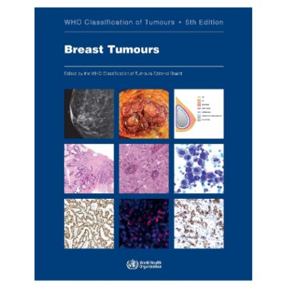 WHO's Classification of Tumours: Breast Tumours; 5th Edition 2019 by World Health Organization