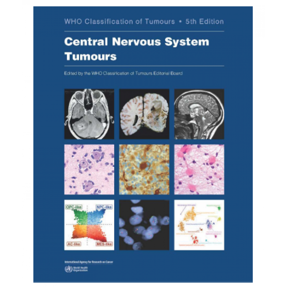 WHO's Classification of Tumours of the Central Nervous System; 5th Edition 2022 By International Agency for Research on Cancer