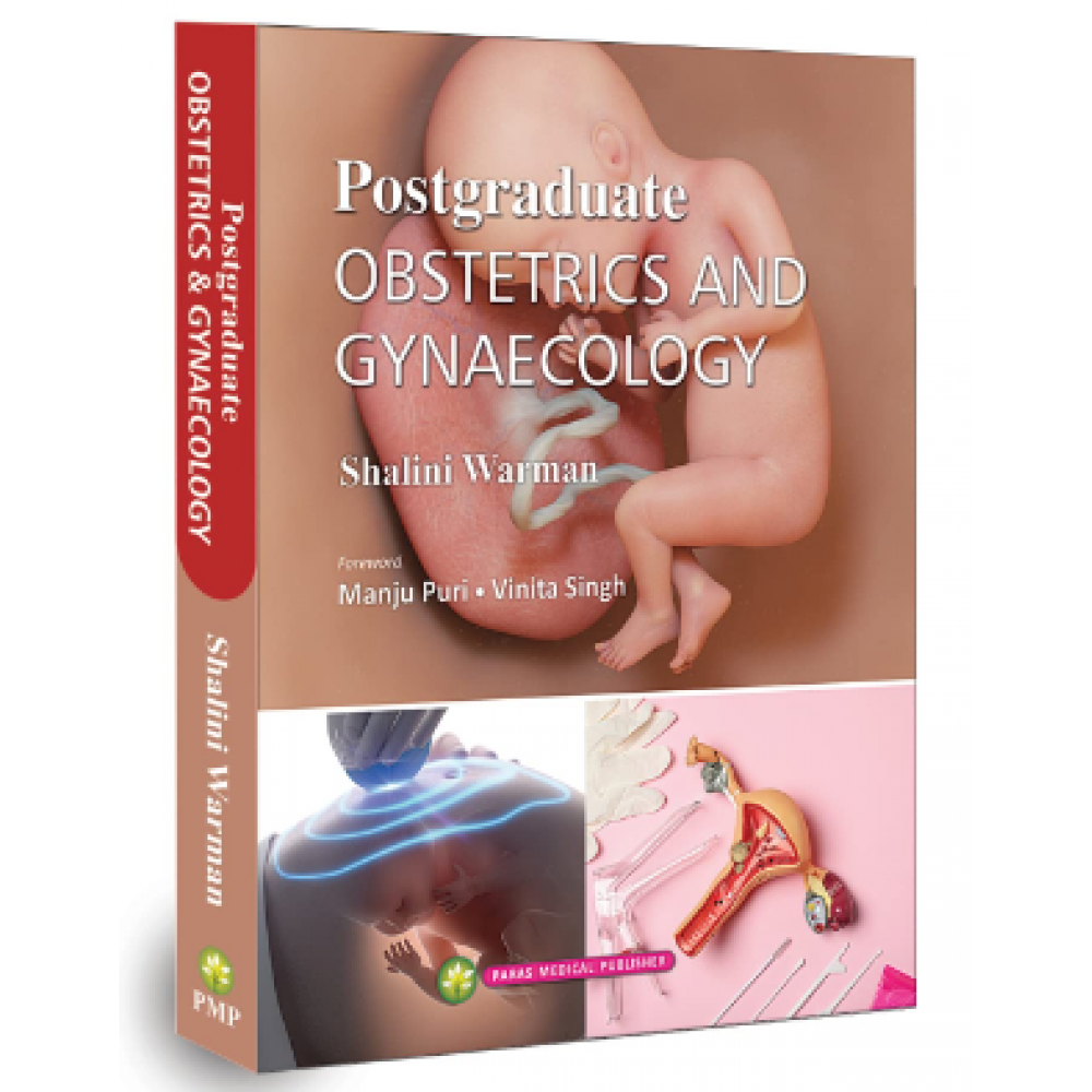 Postgraduate Obstetrics and Gynaecology;1st Edition 2022 by Shalini Warman, Manju Puri & Vinita Singh