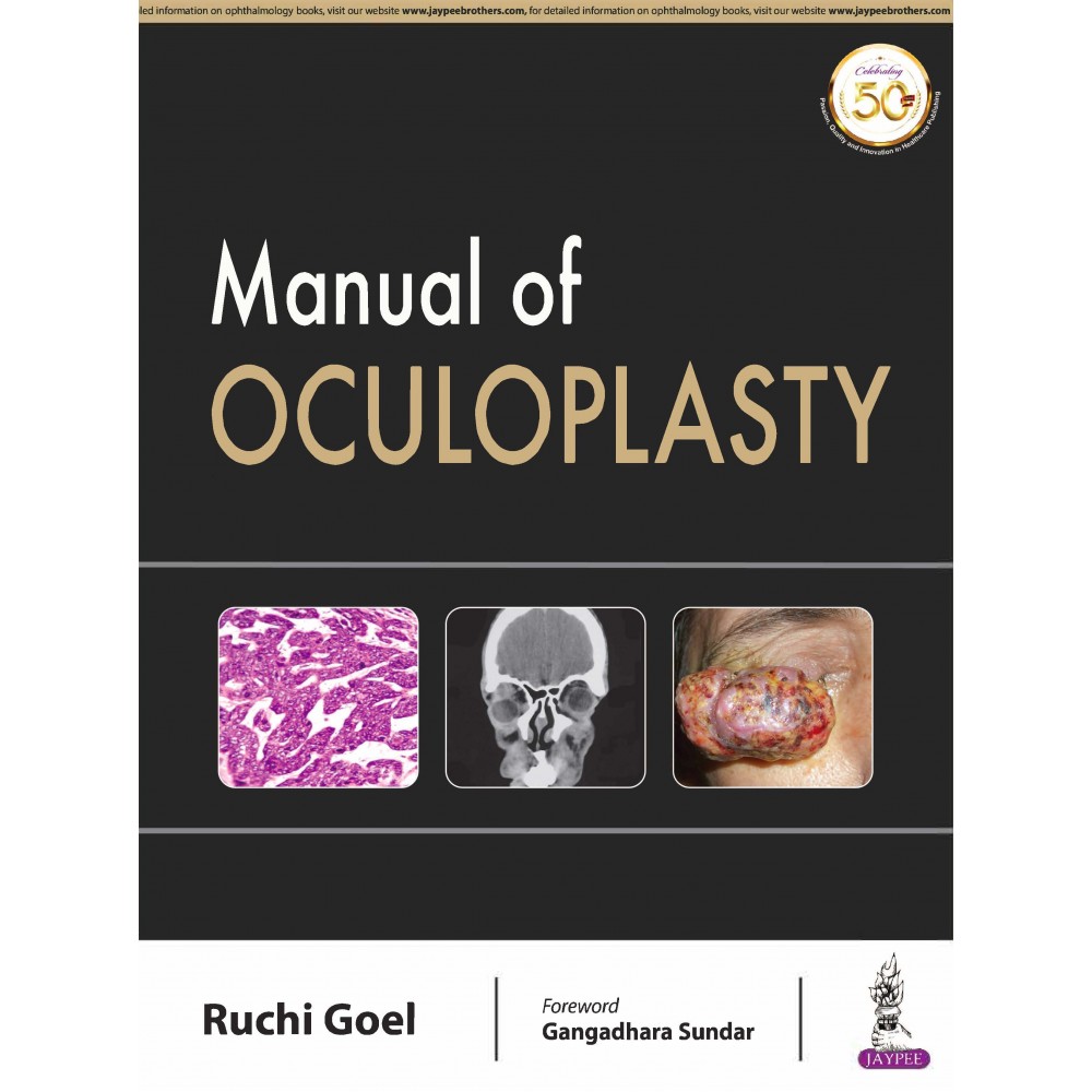 Manual Of Oculoplasty;1st Edition 2019 By Ruchi Goel