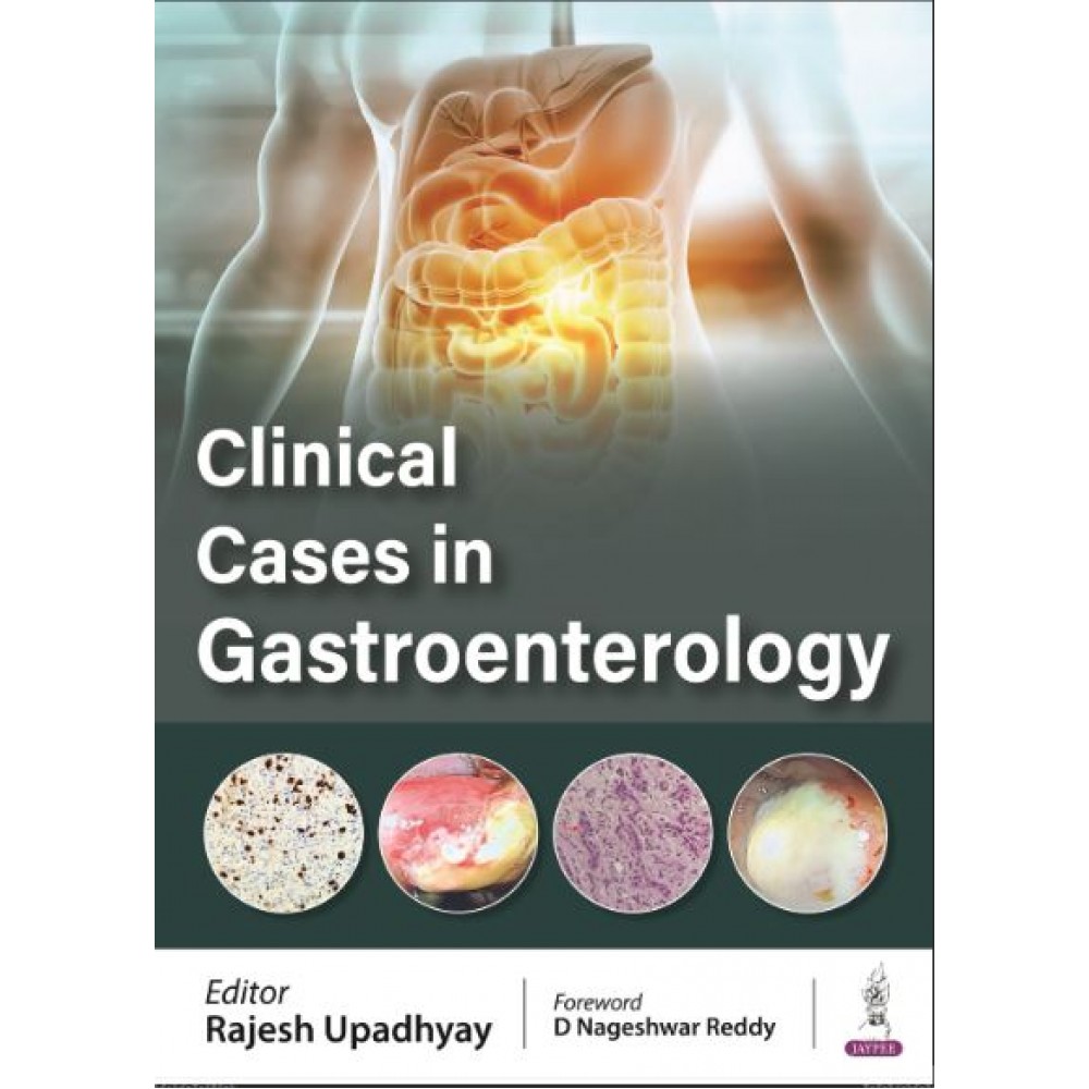 Clinical Cases in Gastroenterology:1st Edition 2024 By Rajesh Upadhyay