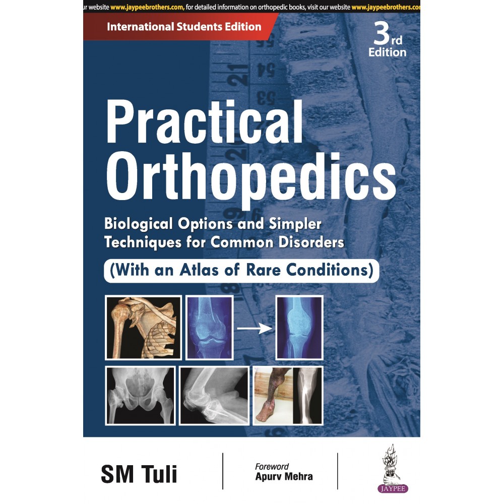 Practical Orthopedics: Biological Options and Simpler Techniques for Common Disorders (With an Atlas of Rare Conditions):3rd Edition 2024 By SM Tuli 