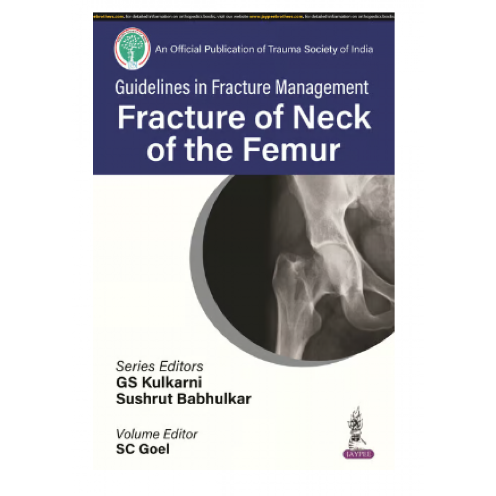 Guidelines in Fracture Management Fracture of Neck of the Femur;1st Edition 2024 By GS Kulkarni