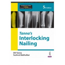 Tanna's Interlocking Nailing;5th Edition 2024 by DD Tanna & Sushrut Babhulkar