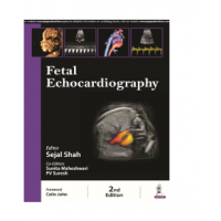 Fetal Echocardiography;2nd Edition 2024 by Sejal Shah, Sunita Maheshwari & PV Suresh