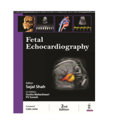 A Practical Guide To Fetal Echocardiography:Normal And Abnormal 